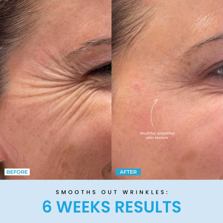 V-Sculpt™ – Redefine Your Jawline in Just 5 Minutes a Day
