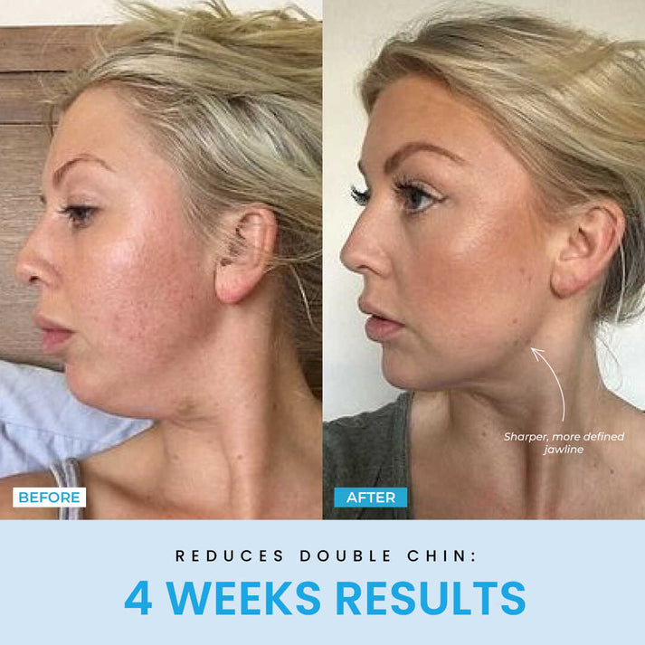 V-Sculpt™ – Redefine Your Jawline in Just 5 Minutes a Day