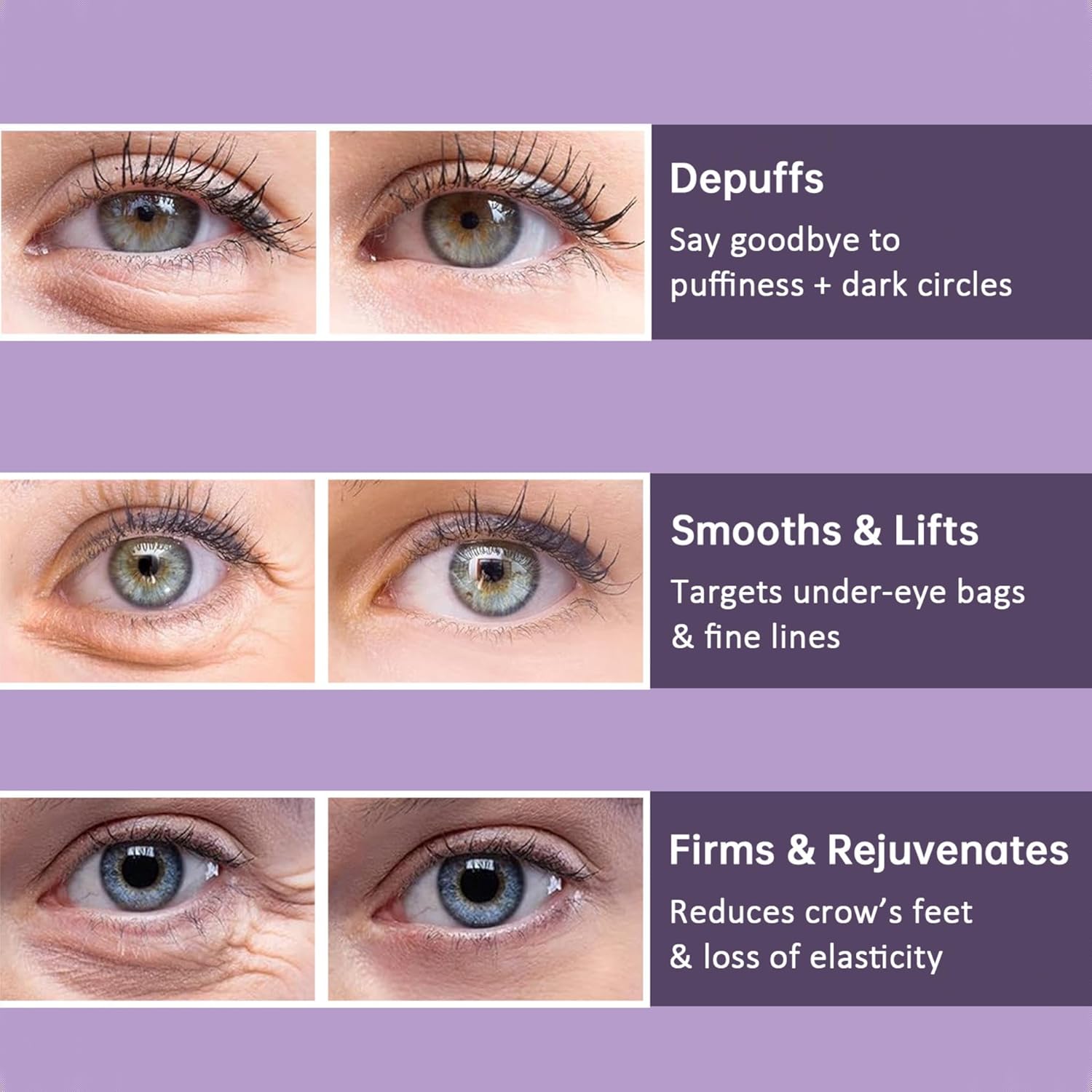 1+1 Free | YouthEyes™ Younger Looking Eyes Instantly