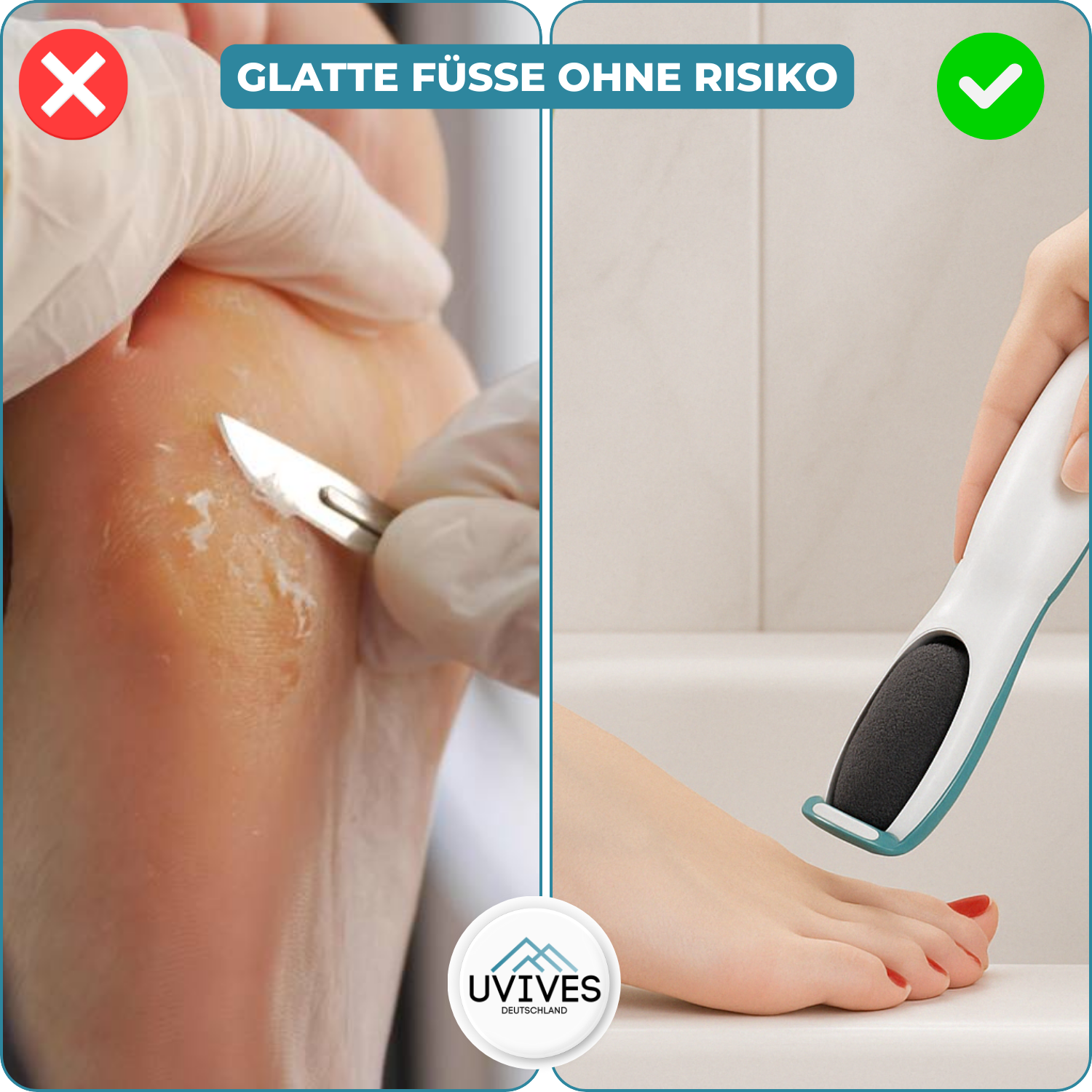 SilkaFeet™ – Effortless, Smooth, Well-Groomed Feet