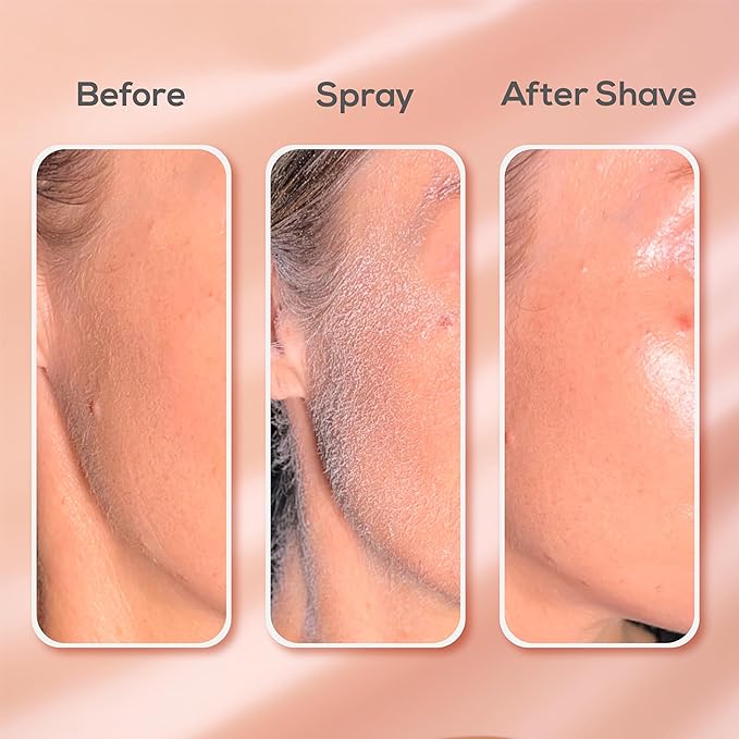 1+1 FREE - GlowSleek™ - Fast & Painless Hair Removal