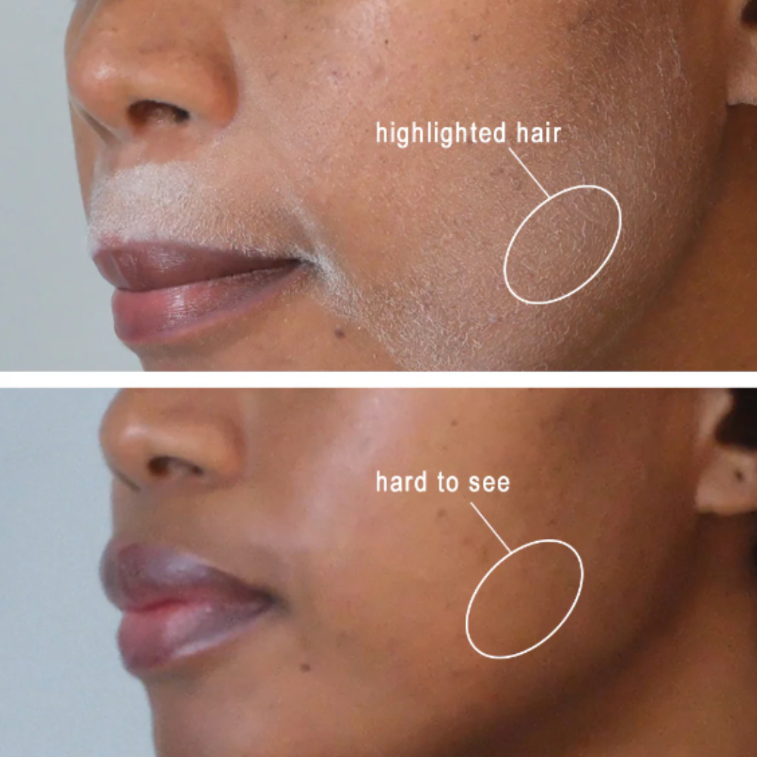 1+1 FREE - GlowSleek™ - Fast & Painless Hair Removal